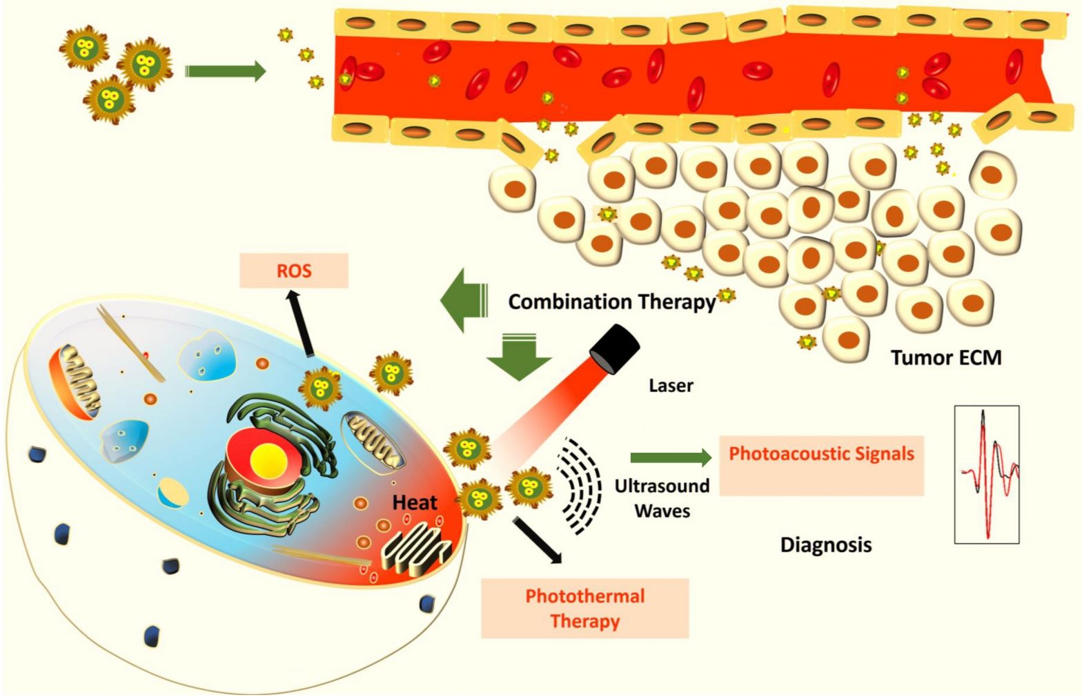 IISc develops Hybrid Nanoparticles to detect and kill cancer cells ...
